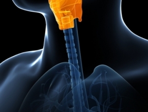 Zdjęcie przedstawia wizualizację wszczepionej protezy głosowej